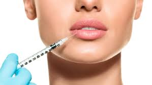 What to Expect After Getting Lip Fillers